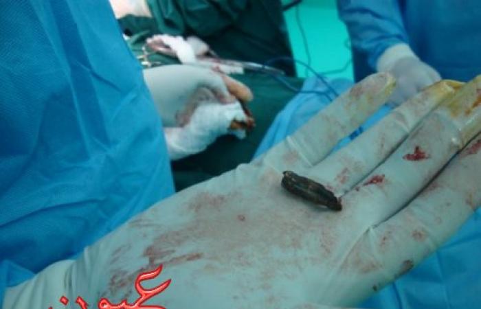 بالصور || تفاصيل جديدة حول إصابة فتاة ميدان الحصري بمدينة أكتوبر بطلق ناري في الظهر من مجهول