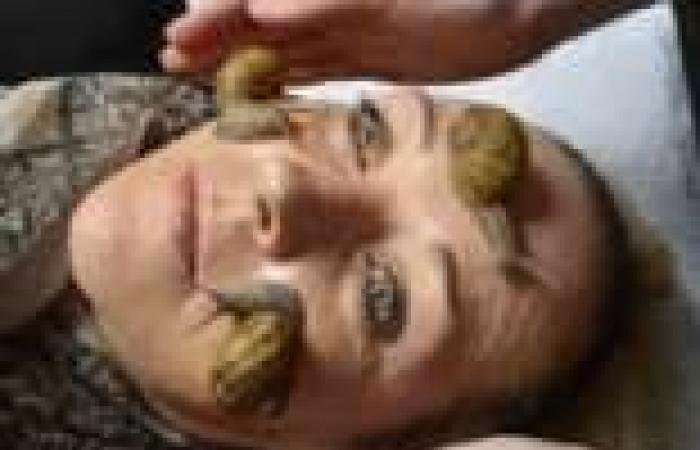 علاج تجاعيد الوجه باستخدام حشرة "الحلزون" في اليابان