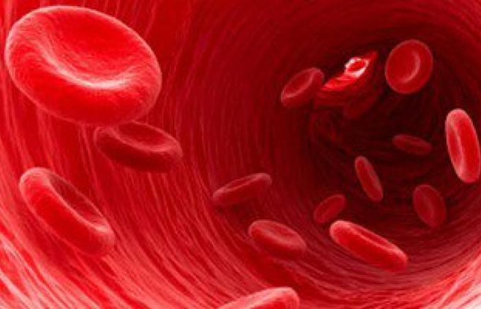 فقر الدم.. الأعراض والتشخيص وطرق العلاج