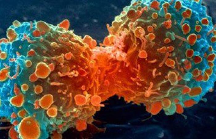 طبيبة أسترالية: أعراض سرطان المبيض تتشابه مع مشاكل صحية أخرى فى النساء