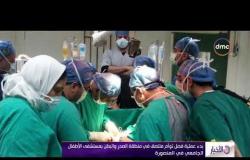 الأخبار - بدء عملية فصل توأم ملتصق في منطقة الصدر والبطن بمستشفى الأطفال الجامعي في المنصورة
