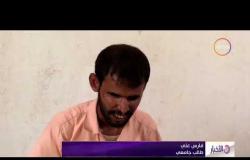 الأخبار - قرية " ماحات " اليمنية بين خطر الحروب وأزمة فقدان البصر