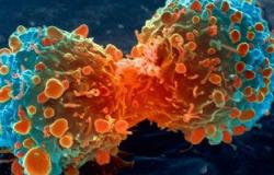 أستاذ أورام: سرطان البروستاتا يتغذى على هرمون الذكورة
