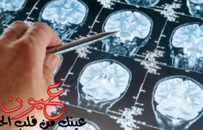 دراسة علمية تحذر: الأشعة المقطعية تزيد خطر الإصابة بأورام المخ