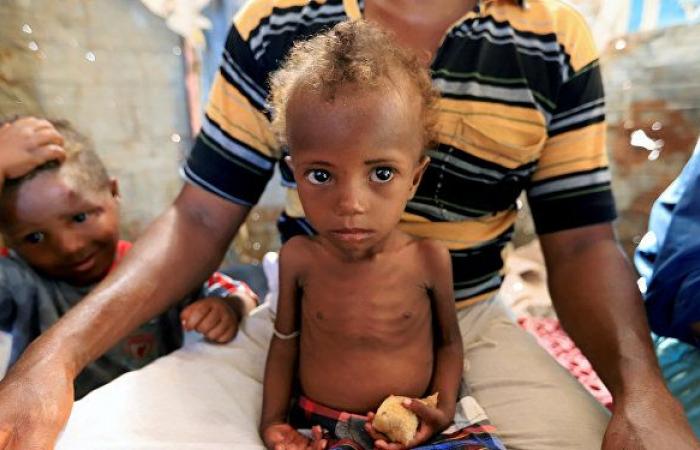 الكوليرا... تحصد أرواح اليمنيين من جديد
