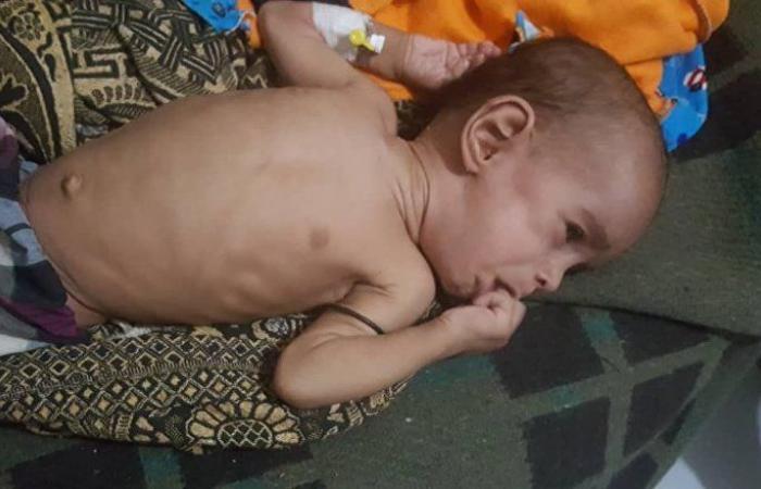 وزير حقوق الإنسان يطالب الأمم المتحدة بسرعة التحرك لإنقاذ اليمن من المجاعة