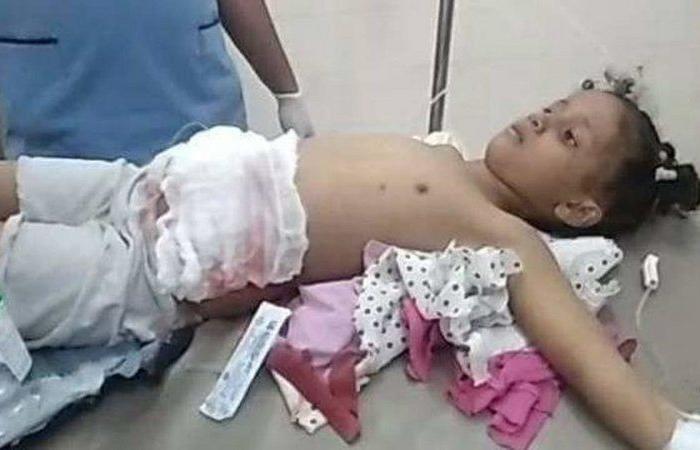رصاص قناص حوثي يختطف حياة طفلة بالخامسة من عمرها بمدينة تعز