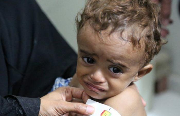 "الصحة العالمية" تنظم ورشة في عدن لمتابعة حالات سوء التغذية