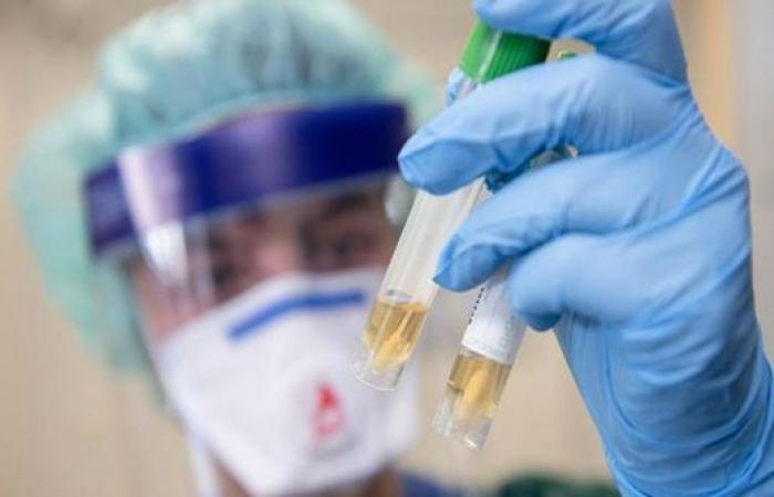 9 وفيات  730 اصابة جديدة بفيروس كورونا في الاردن