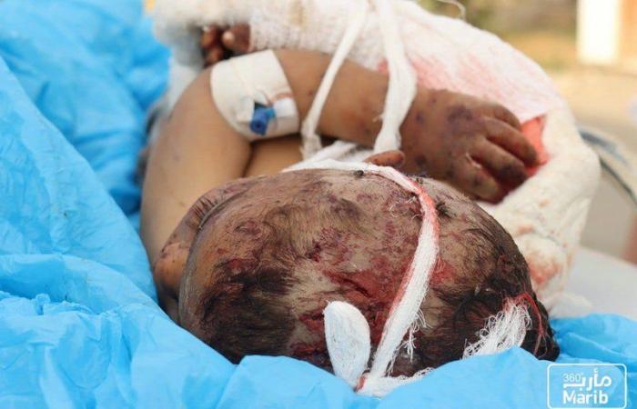 صور مؤلمة لمجزرة الحوثي بمأرب.. مقتل طفلين وإصابة 27 مدنياً حصيلة الضحايا
