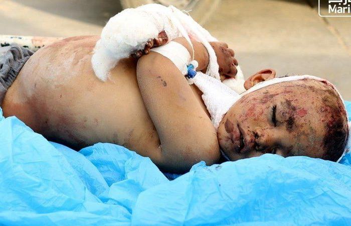 صور مؤلمة لمجزرة الحوثي بمأرب.. مقتل طفلين وإصابة 27 مدنياً حصيلة الضحايا