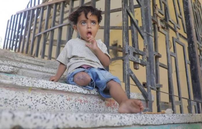 معاناة أمير العامري.. براءة طفل لم تنقذه من غدر الحوثي
