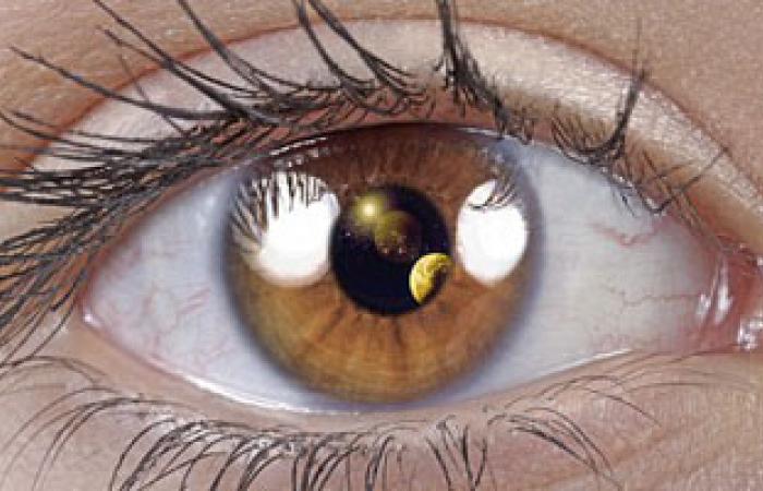 "تصوير شبكية العين".. أحدث وسيلة لتوقع خطر الإصابة بالسكتة الدماغية