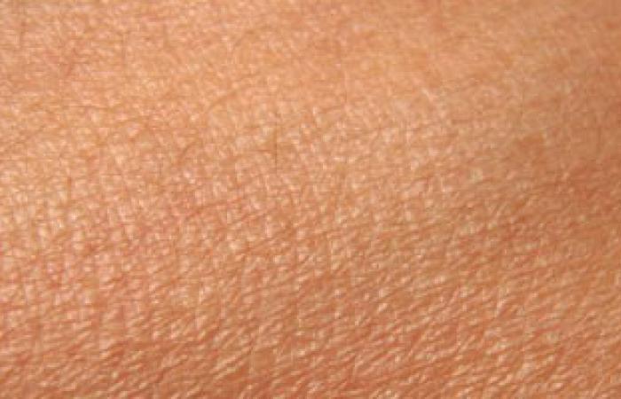 دراسة: الرجال أكثر عرضة للوفاة بسرطان الجلد بالمقارنة بالسيدات