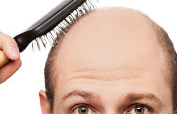 عملية زراعة الشعر لعلاج الصلع تتم على مراحل