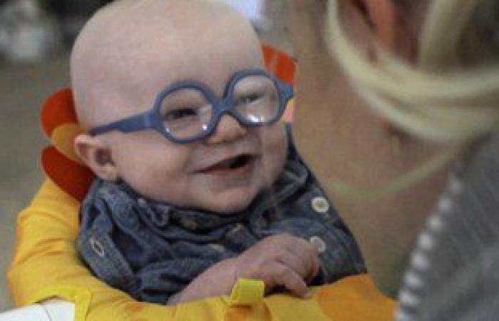 بالصور.. طفل 4 شهور يرى أمه لأول مرة بابتسامة خاطفة بسبب مرض نادر