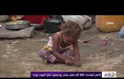 الأخبار - الأمم المتحدة: 400 ألف طفل يمني يواجهون خطر الموت جوعا