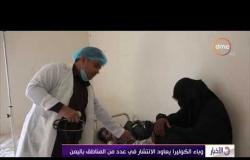 الأخبار - وباء الكوليرا يعاود الانتشار في عدد من المناطق باليمن