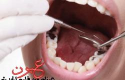 علاج تسوس الأسنان فى المراحل المبكرة والمتقدمة