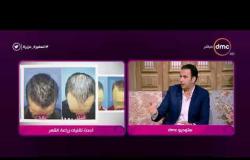 السفيرة عزيزة - د/ أحمد مكاوي - يوضح أحدث تقنيات " زراعة الشعر "
