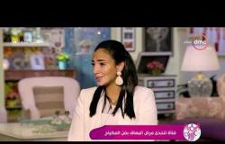 السفيرة عزيزة - لجينة صلاح - تتحدث عن بداية عملها في التجميل وكيف بدأ رغم مرضها " البهاق "