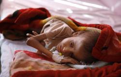 وزارة الصحة اليمنية في صنعاء: خسائر قطاع الصحة تجاوزت 10 مليارات دولار بفعل عمليات التحالف