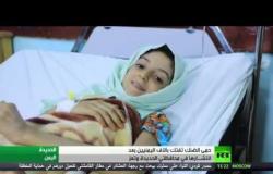 حمى الضنك تجتاح مناطق في اليمن