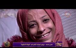 مساء dmc - هدير محمد.. عروس تتعرض للتنمر عبر السوشيال ميديا