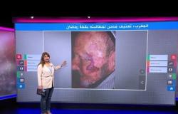 مسن مغربي يتعرض لاعتداء من رجل أمن لمطالبته بـ"قفة رمضان"
