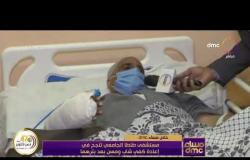 مساء dmc - مستشفى طنطا الجامعي تنجح في إعادة كفي شاب ومسن بعد بترهما