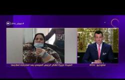 مساء dmc - الرئيس عبد الفتاح السيسي يوجه بعلاج السيدة "عزيزة" مريضة داء الفيل