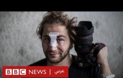 أمير الحلبي: ترك سوريا هربا من العنف ليصاب في مظاهرات بفرنسا