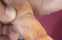 بالصور.. جولة رقابية تكشف الأيادي المجروحة والأظافر المقززة لعمالة مطاعم جنوبي الطائف
