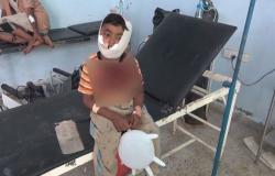 بالفيديو.. إصابة طفل برصاص قناصة ميليشيا الحوثي بالحديدة
