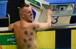 ليست بقعاً غريبة.. "حجامة السباحين" تخطف الأضواء في أولمبياد طوكيو