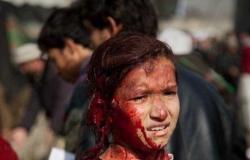لا تخدعك مواقع التواصل.. حقيقة صورة الطفلة الناجية من هجوم كابول