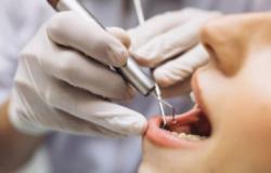ضبط شخصين في الأردن يمارسان طب وتجميل الأسنان بمركبة متنقلة