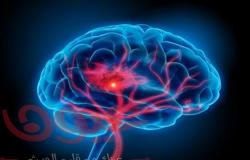 هل يمكن الشفاء من نزيف المخ؟