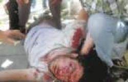 عاجل| "الصحة": إصابة 10 متظاهرين بجروح في اشتباكات بين "الإخوان" ومتظاهرين بالإسكندرية