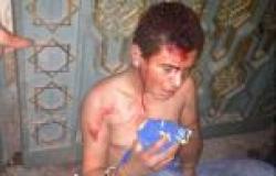 7 من الضحايا يكشفون وقائع «حفلة التعذيب» في أحداث «الاتحادية»