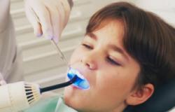 سوس الأسنان يقلل فرص الإصابة بسرطان الفم والحلق