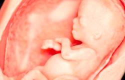 تعديل وضع الجنين قبل الولادة ضرورى للحماية من المخاطر على الأم والجنين