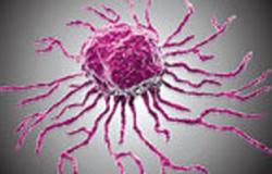 الصوم وسيلة جديدة لعلاج بعض الأمراض السرطانية