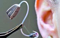 علماء يطورون جهازا يساعد الكثير من الصم على السمع