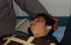 اثنان من المصريين المصابين فى تفجيرات القبة الليبية: مدخرات 4 سنوات ضاعت
