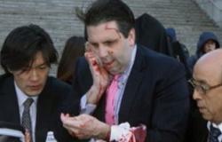 الفرنسية: إصابة السفير الأمريكى بكوريا الجنوبية بجروح خطيرة فى هجوم مسلح