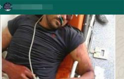 "واتس آب اليوم السابع": صورة لإرهابى مصاب إثر مشاركته فى حادث معبد الكرنك