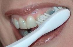 نصائح تخليك تعالج أسنانك وكأنك طبيب.. أهمها استخدام الفراولة والبيكربونات