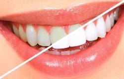 جهاز جديد لعلاج الأسنان بلا ألم يجعل الناس تقبل على العيادات