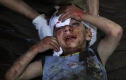 أطباء بلا حدود: 70 قتيلا و550 جريحا فى القصف الجوى على مدينة دوما السورية
